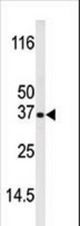 Western blot of anti-Bik antibody in mouse liver tissue lysate (35 ug/lane). Bik(arrow) was detected using the purified antibody.