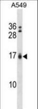 Bik Antibody (BH3) western blot of A549 cell line lysates (35 ug/lane). The Bik antibody detected the Bik protein (arrow).
