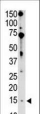 The anti-Bik BH3 domain antibody is used in Western blot to detect Bik BH3 in mouse brain tissue lysate.