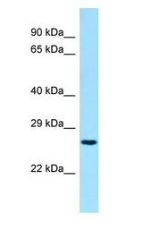 BIN3 antibody Western Blot of Fetal Liver.