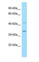 BIN3 antibody Western Blot of THP-1 cell lysate.