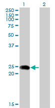 Western blot of BIN3 expression in transfected 293T cell line by BIN3 monoclonal antibody (M02), clone 1H8.