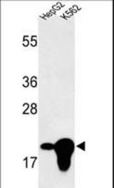 Western blot of BIN3 Antibody in HepG2, K562 cell line lysates (35 ug/lane). BIN3 (arrow) was detected using the purified antibody.