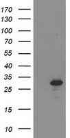HEK293T cells were transfected with the pCMV6-ENTRY control (Left lane) or pCMV6-ENTRY BIN3 (Right lane) cDNA for 48 hrs and lysed. Equivalent amounts of cell lysates (5 ug per lane) were separated by SDS-PAGE and immunoblotted with anti-BIN3.
