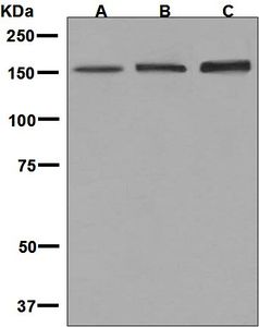 Western blot analysis on (A) human tonsil, (B) human placenta, and (C) fetal kidney lysates using anti-NAIP antibody.