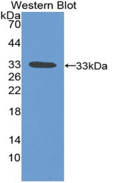 Western blot of recombinant BIRC1 / NAIP.