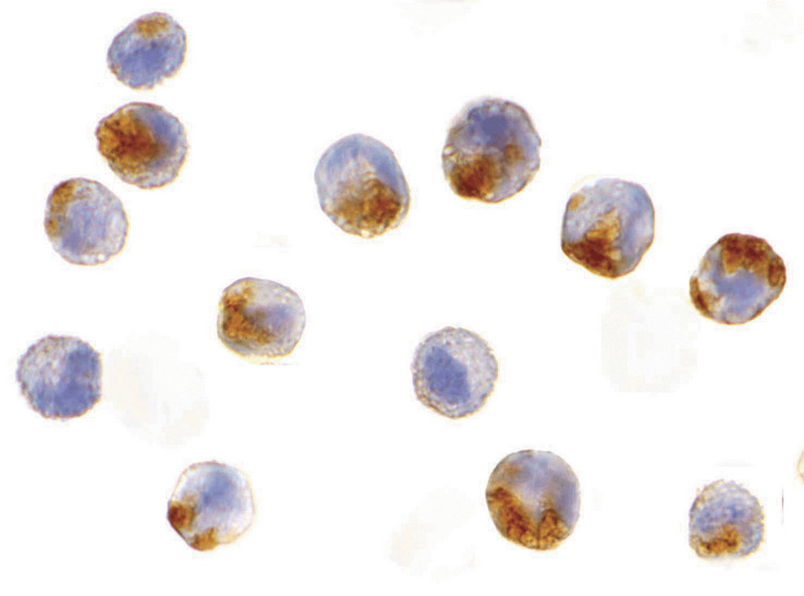 Immunocytochemistry of NAIP in A549 cells with NAIP antibody at 10 ug/ml.