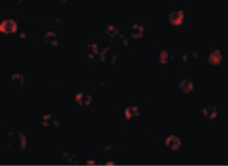 Immunofluorescence of NAIP in A549 cells with NAIP antibody at 20 ug/ml.