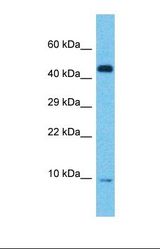 Western blot of Human Pancreas Tumor. ACP1 antibody dilution 1.0 ug/ml.