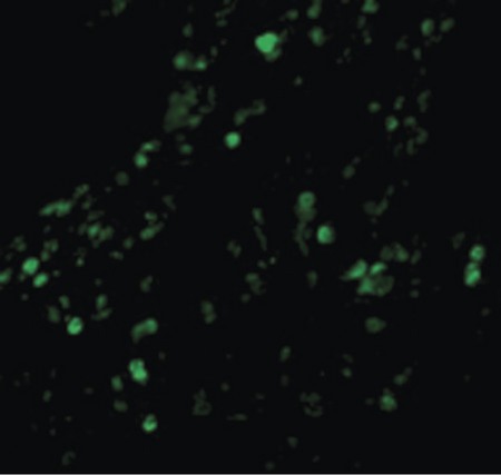 Immunofluorescence of cIAP in Human Lung cells with cIAP antibody at 20 ug/ml.