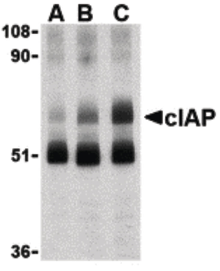 Western blot of c-IAP in human lung lysate with c-IAP antibody at 1 (lane A), 2 (lane B), and 4 (lane C) ug/ml, respectively.
