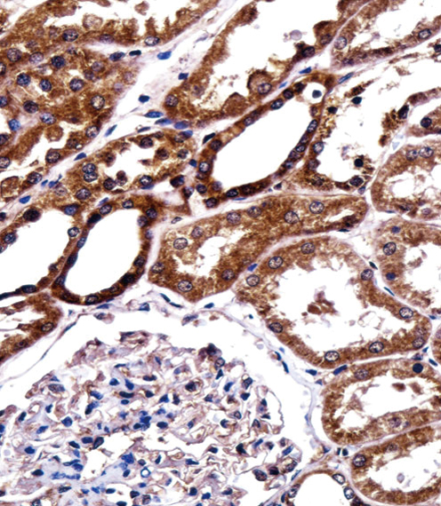 BIRC2 Antibody immunohistochemistry of formalin-fixed and paraffin-embedded human kidney tissue followed by peroxidase-conjugated secondary antibody and DAB staining.