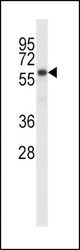 BIRC2 Antibody western blot of MDA-MB231 cell line lysates (35 ug/lane). The BIRC2 antibody detected the BIRC2 protein (arrow).