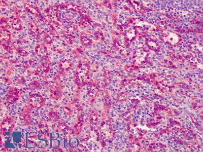 Anti-cIAP2 antibody IHC of human spleen. Immunohistochemistry of formalin-fixed, paraffin-embedded tissue after heat-induced antigen retrieval. Antibody LS-B5024 concentration 5 ug/ml.