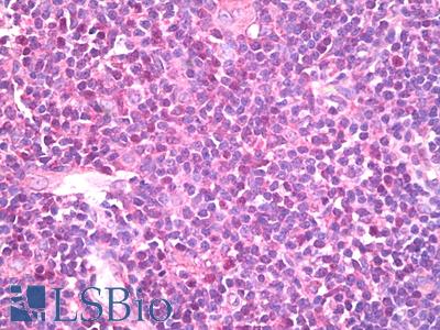 Anti-BIRC3 / cIAP2 antibody IHC of human thymus. Immunohistochemistry of formalin-fixed, paraffin-embedded tissue after heat-induced antigen retrieval. Antibody LS-B7786 dilution 1:50.