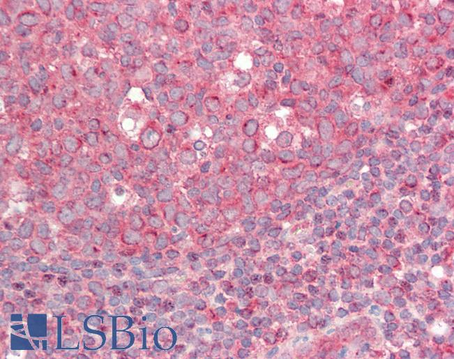 Anti-BIRC3 / cIAP2 antibody IHC staining of human tonsil. Immunohistochemistry of formalin-fixed, paraffin-embedded tissue after heat-induced antigen retrieval. Antibody LS-B11176 concentration 5 ug/ml.