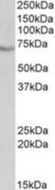 BIRC3 antibody (0.1 ug/ml) staining of HeLa lysate (35 ug protein/ml in RIPA buffer). Primary incubation was 1 hour. Detected by chemiluminescence.