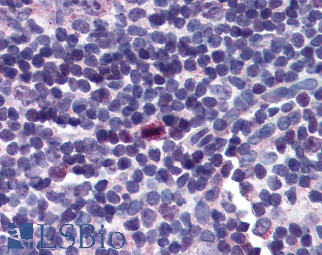 Anti-BIRC5 / Survivin antibody IHC of human tonsil. Immunohistochemistry of formalin-fixed, paraffin-embedded tissue after heat-induced antigen retrieval. Antibody LS-B189 concentration 5 ug/ml.
