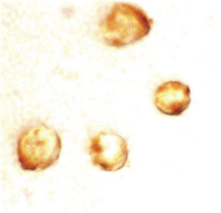 Immunocytochemistry staining of MOLT4 cells using survivin at 10 ug/ml.