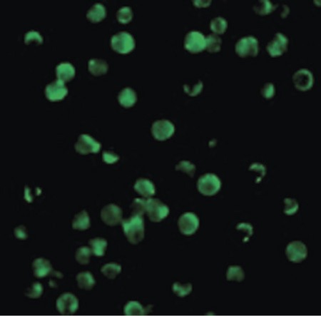 Immunofluorescence of Survivin in Molt4 cells with Survivin antibody at 10 ug/ml.