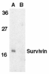 Western blot of survivin in MOLT4 cell lysate in the absence (A) or presence (B) of blocking peptide with Survivin antibody at 1 ug/ml.