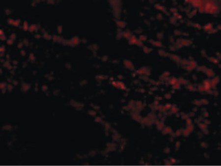 Immunofluorescence of Livin in Human Small Intestine cells with Livin antibody at 20 ug/ml.