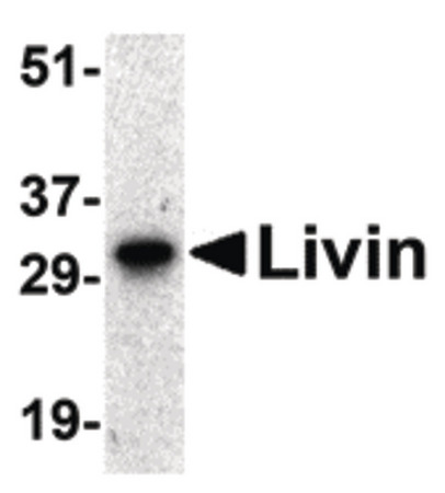 Western blot of Livin expression in human Raji cell lysate with Livin antibody at 0.5 ug/ml.