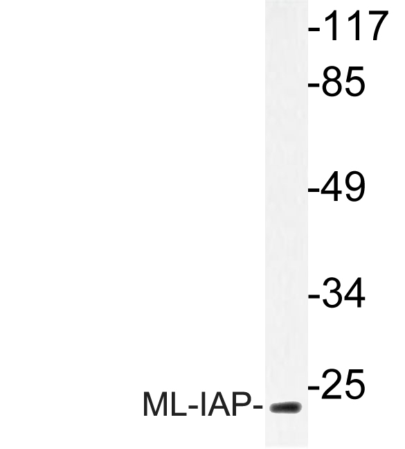 Western blot of ML-IAP (E211) pAb in extracts from COLO cells.
