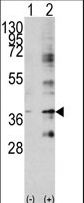 Western blot of BIRC7 (arrow) using rabbit polyclonal BIRC7 Antibody. 293 cell lysates (2 ug/lane) either nontransfected (Lane 1) or transiently transfected with the BIRC7 gene (Lane 2) (Origene Technologies).