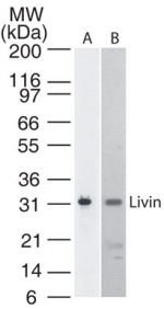 Western blot detection of Livin in A) Livin transfected cell lysate and B) U266 cell lysate. A protein band of approximate molecular weight of 31 kDa is detected using antibody at 2 ug/ml dilution.