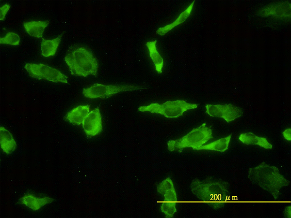 Immunofluorescence of monoclonal antibody to ACP2 on HeLa cell. [antibody concentration 10 ug/ml]