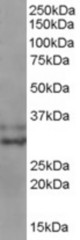 Staining (0.3 ug/ml) of MOLT4 lysate (RIPA buffer, 35 ug total protein per lane). Primary incubated for 1 hour. Detected using chemiluminescence.
