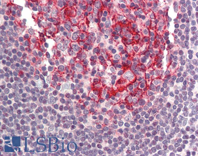 Anti-BIRC8 / ILP2 antibody IHC of human small intestine, Peyer's patch. Immunohistochemistry of formalin-fixed, paraffin-embedded tissue after heat-induced antigen retrieval. Antibody LS-B457 concentration 5 ug/ml.