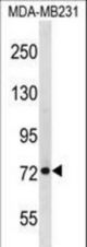 RMI1 Antibody western blot of MDA-MB231 cell line lysates (35 ug/lane). The RMI1 antibody detected the RMI1 protein (arrow).
