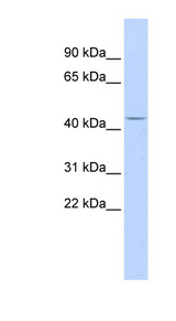ACP2 / Acid Phosphatase 2 antibody LS-B5788 Western blot of Fetal Brain lysate.