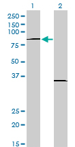 Western Blot analysis of PRDM1 expression in transfected 293T cell line by PRDM1 monoclonal antibody (M01), clone 2B10.Lane 1: PRDM1 transfected lysate(88 KDa).Lane 2: Non-transfected lysate.