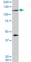 PRDM1 monoclonal antibody (M01), clone 2B10. Western Blot analysis of PRDM1 expression in human tongue.