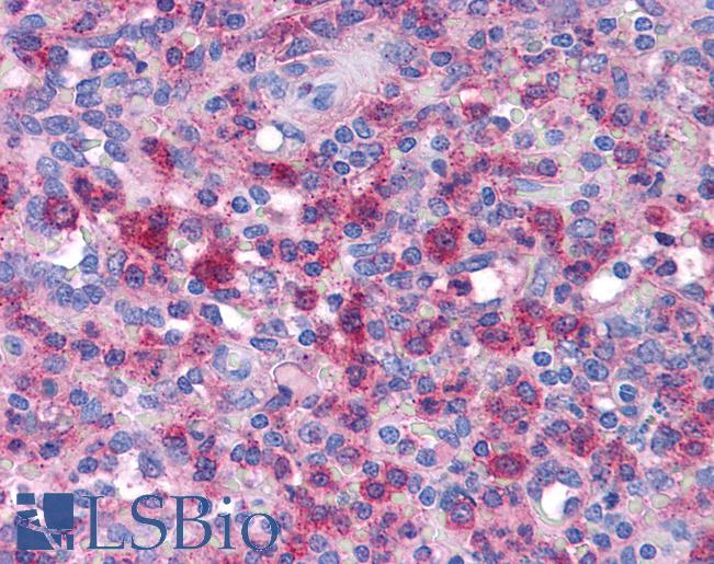 Anti-BLIMP-1 antibody IHC of human spleen. Immunohistochemistry of formalin-fixed, paraffin-embedded tissue after heat-induced antigen retrieval. Antibody LS-B4694 concentration 5 ug/ml.