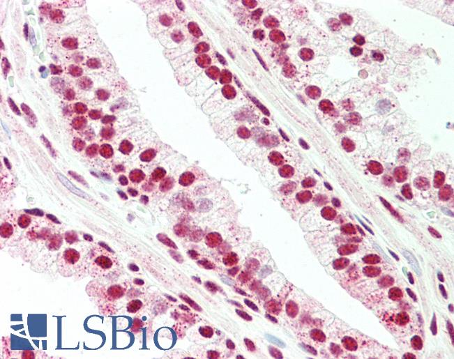 Anti-BLIMP1 / PRDM1 antibody IHC staining of human prostate. Immunohistochemistry of formalin-fixed, paraffin-embedded tissue after heat-induced antigen retrieval.