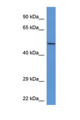 ACP2 / Acid Phosphatase 2 antibody LS-C135173 Western blot of Rat Kidney lysate. Antibody concentration 1 ug/ml.