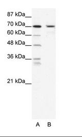 A: Marker, B: HepG2 Cell Lysate