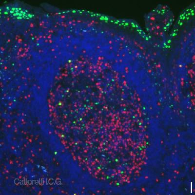 Double IF for Blimp-1 (green) and Ki-67 (proliferation, red) with DAPI counterstain, at 10x magnification (scale bar is 10mum). Positive surface epithelium and centrocytes are labeled.