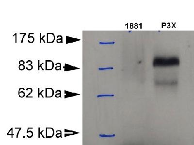 Detection of Blimp-1 in murine plasmacytoma cell lysate (P3X). 1881: murine pre-B cell lysate (negative control).