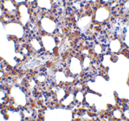 Immunohistochemistry of Blimp-1 in mouse lung tissue with Blimp-1 antibody at 5 ug/ml.