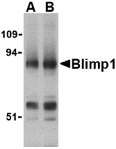 Western blot of Blimp-1 in mouse lung tissue lysate with Blimp-1 antibody at (A) 0.5 and (B) 1 ug/ml.