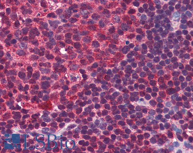Anti-BLIMP-1 antibody IHC of human colon, lymphoid follicle. Immunohistochemistry of formalin-fixed, paraffin-embedded tissue after heat-induced antigen retrieval. Antibody LS-B2722 concentration 3 ug/ml.