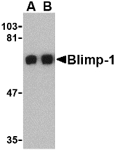 Western blot of Blimp-1 in A549 cell lysate with Blimp-1 antibody at (A) 0.5 and (B) 1 ug/ml.