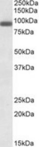 PRDM1 antibody (0.3 ug/ml) staining of A431 lysate (35 ug protein/ml in RIPA buffer). Primary incubation was 1 hour. Detected by chemiluminescence.