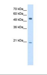HepG2 cell lysate. Antibody concentration: 2.5 ug/ml. Gel concentration: 12%.