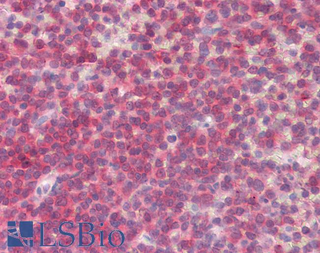 Anti-BLK antibody IHC staining of human spleen. Immunohistochemistry of formalin-fixed, paraffin-embedded tissue after heat-induced antigen retrieval.